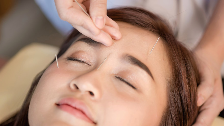 Acupuncture Therapy in Clive, IA