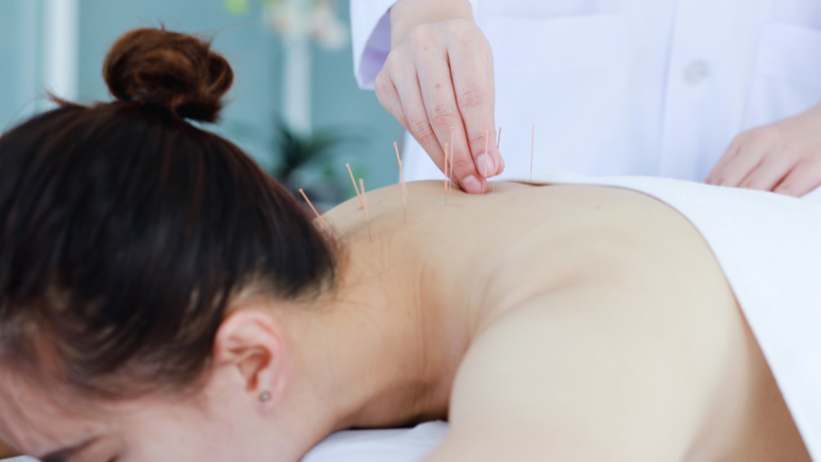 Acupuncture Therapy in Clive, IA